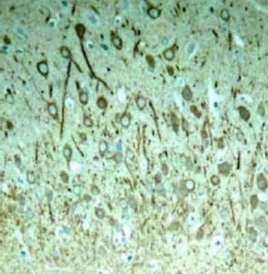 Immunohistochemistry: Tau [p Thr231] Antibody [NB100-82249]